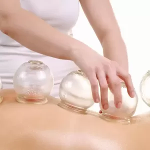 cupping therapy